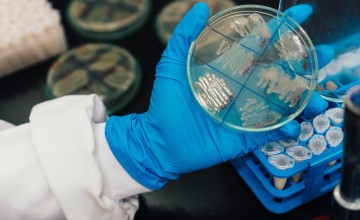 Medikal Ürünlerde Mikrobiyolojik Analizler