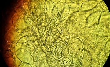Candida albicans Analizi
