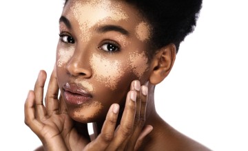 Cilt Beyazlatıcı (Melanin)