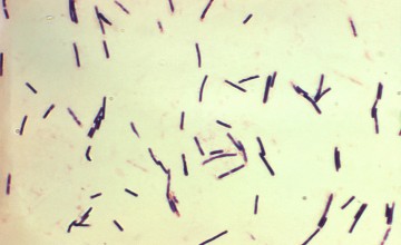 Clostridium perfringens