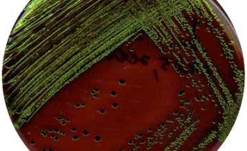 Escherichia Coli Analizi