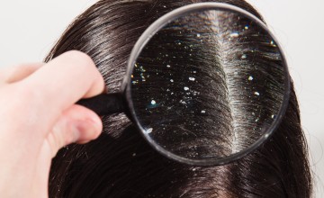 Kepek Önleyici (Anti Dandruff)