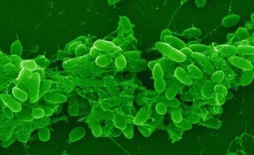 Pseudomonas aeruginosa Analizi