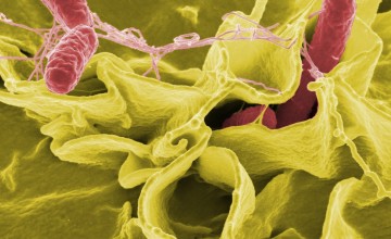 Salmonella spp