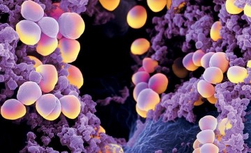 Staphylococcus aureus Analizi