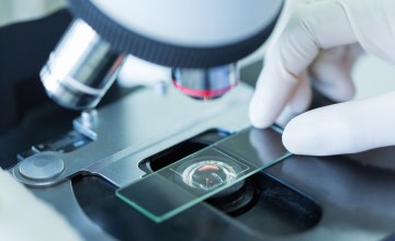 Tıbbi Cihazlarda ISO 10993 Biyolojik Değerlendirme ve Temizlik Validasyonu