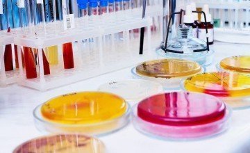 Yüzey ve Malzemelerde Antibakteriyel Etkinlik Testleri
