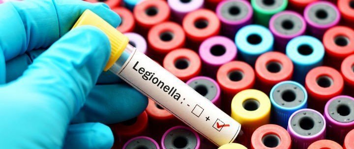 Legionella Üremesi İçin Riskli Ortamlar